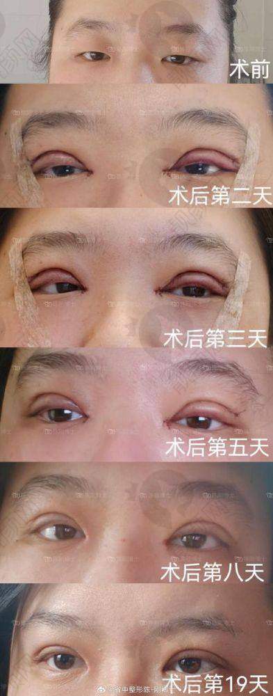 上海眼王张宇医生口碑和评价