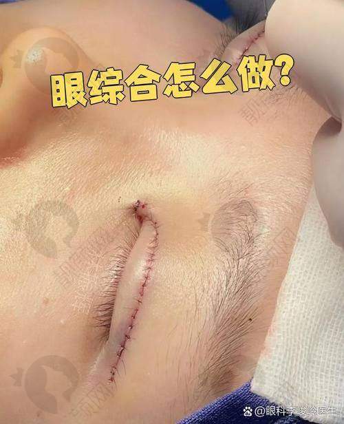 上海眼王张宇医生怎么预约？