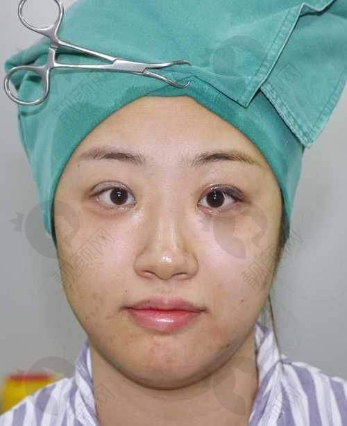 上海眼王张宇医生个人资料及简历