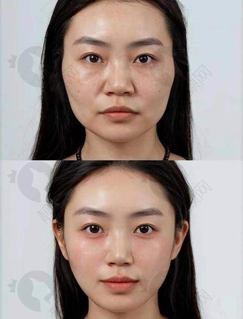 金钟圭项目价格表参考