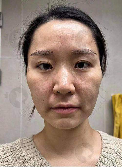 金钟圭在哪家医院