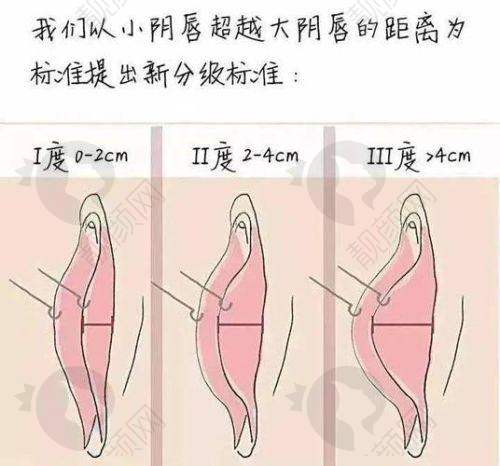 成都市第三人民医院：区域医疗的私密整形“先锋”
