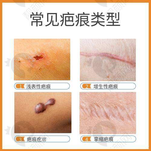 吉大一院整形科坐诊医生实力强，口碑超棒