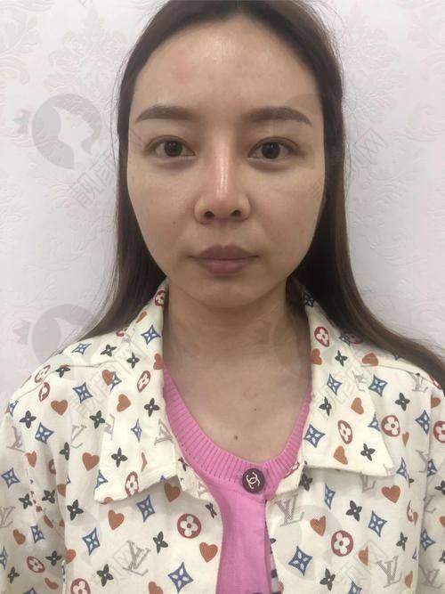 长沙雅美整形田芳斌医生简介