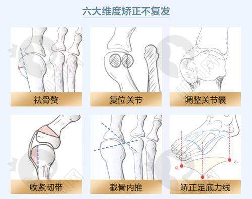 七、南宁爱思特整形医院怎么预约：