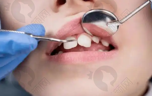 云阳众植博仕口腔的优点