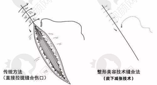 一、深圳大学总医院整形美容科怎么样？