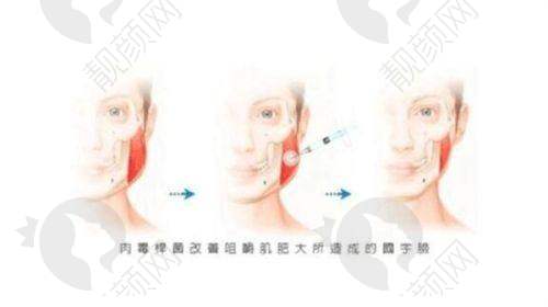 重庆医科大学附属第一医院:历史悠久的国有整形力量