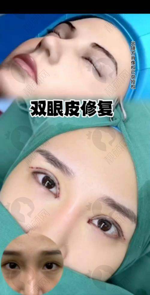 大连爱德丽格刘志刚硬核眼修复技术揭秘
