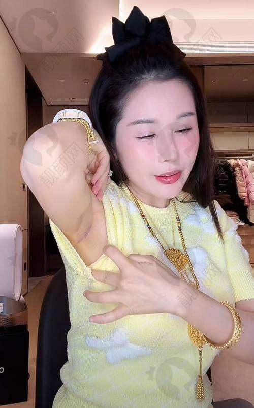 李建东怎么预约？