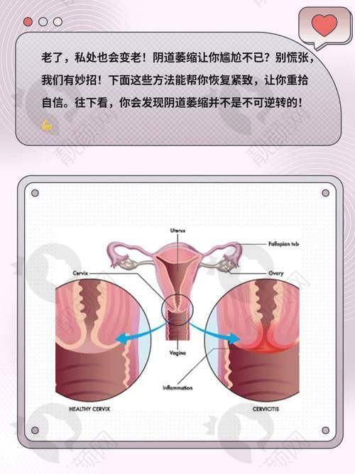 紧缩针预约3步走，选正规医院不踩坑
