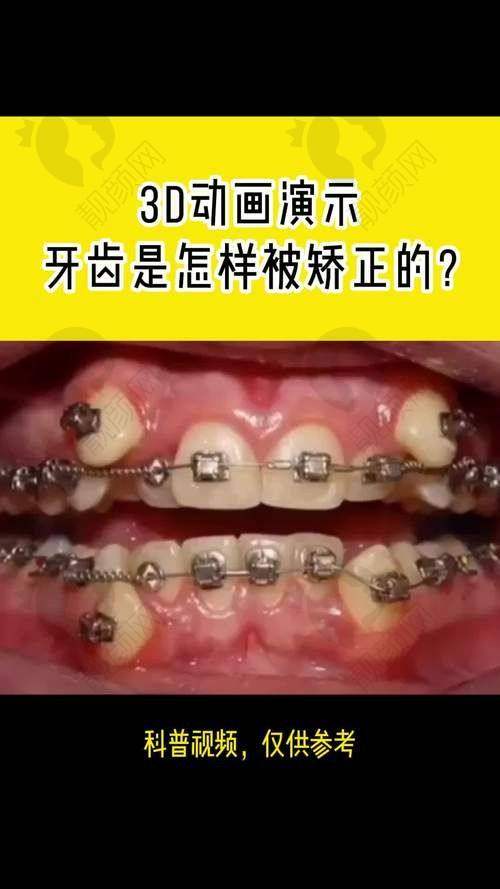 刘兴华怎么预约？