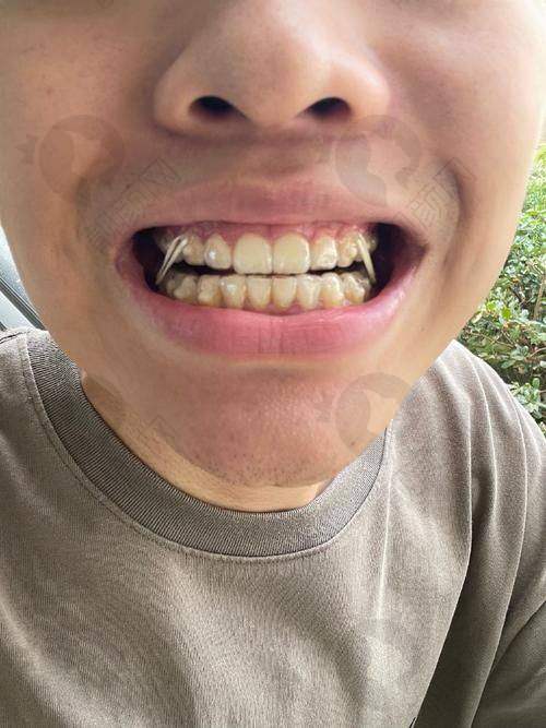 重庆云阳众植博仕口腔的地址、路线及预约方式
