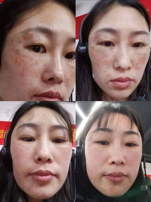 大连美天医疗美容医院：经验多，设备精良祛斑强