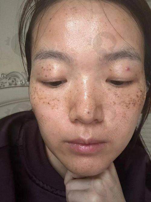 大连高岚医疗美容门诊部：个性化祛斑方案，成效自然美观