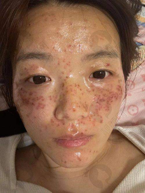 大连星妍医疗美容门诊部：祛斑性价比高，手法技术熟练