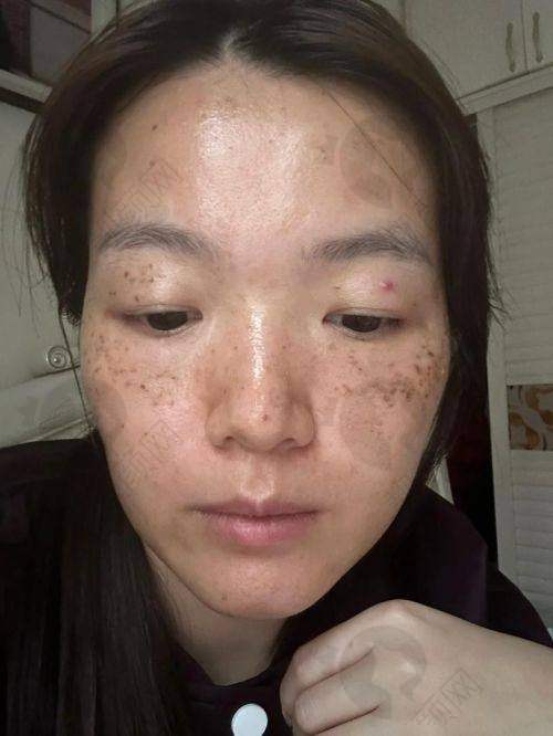 大连爱德丽格医疗美容门诊部：眼修复出名，祛斑也出色