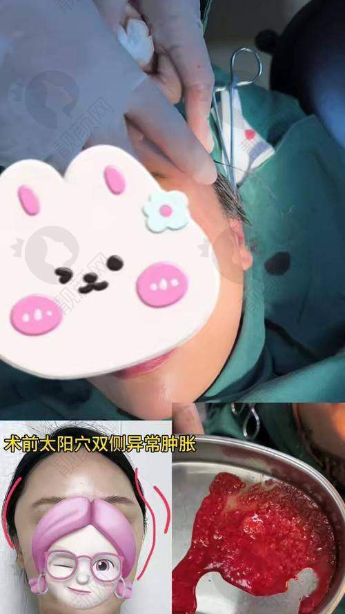 广州生长因子取出口碑医院医生名单公布！广州中家医家庭医生——黄广香医生经验多