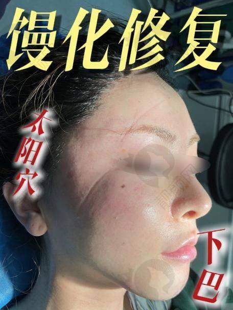 广州生长因子取出口碑医院医生名单公布！广州曙光整形医院——蒋思军 医生技艺不错