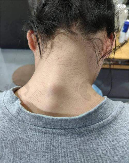 温州徐淑卿医生简介