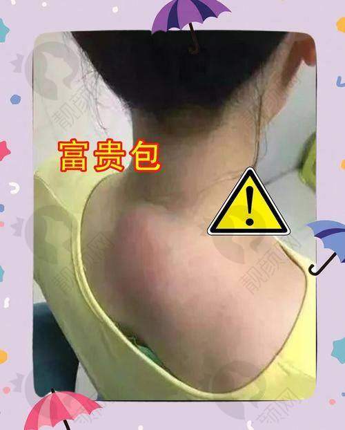 温州徐淑卿医生口碑好