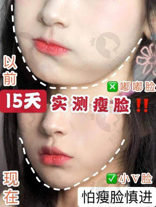 预约方式：在线预约更方便
