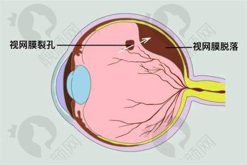 抚顺白内障免费政策是哪些?2025全新政策揭秘——抚顺市中 心医院地址好找