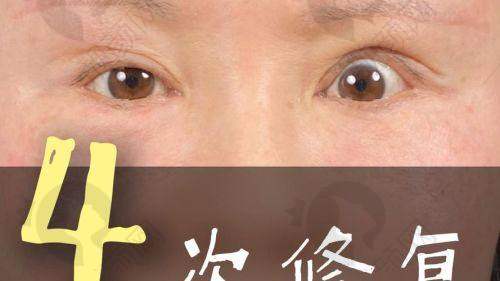 吕方中医生：审美在线打造自然美眼