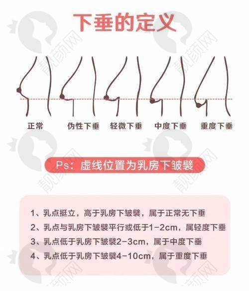 口碑超棒：患者真实评价见证实力