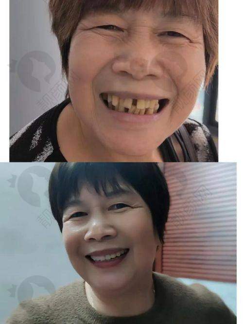结语