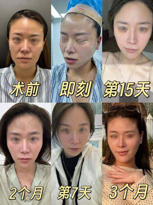 眭云鹏项目价格表参考