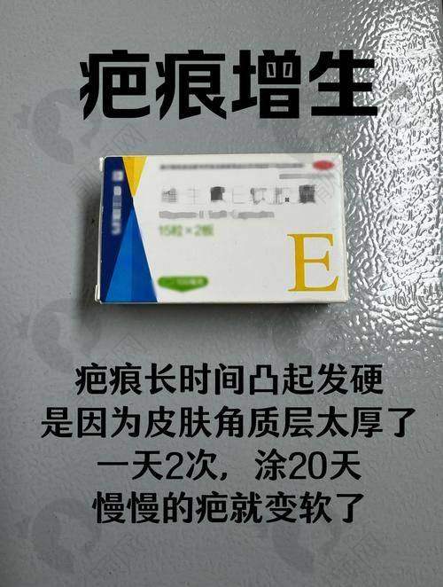 成都友谊医院疤痕科：正规靠谱，收费透明