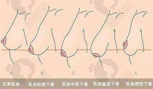 一、中山爱思特美容医院怎么样？