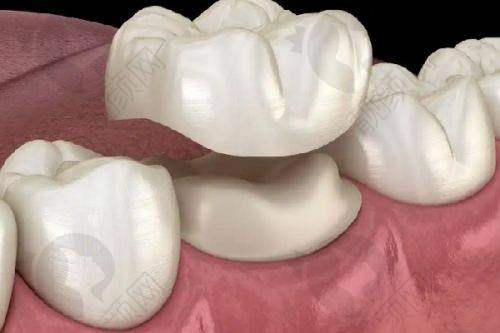 华 西种牙:3D导航技术的优势