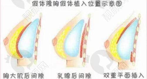柳州新生天美植发优势