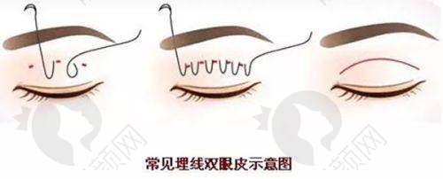 热门项目