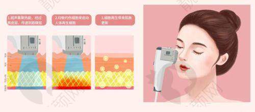 与其他植发医院对比