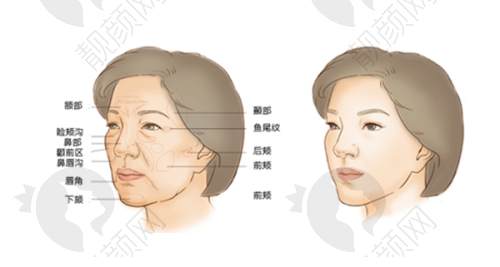 医院地址及预约方式