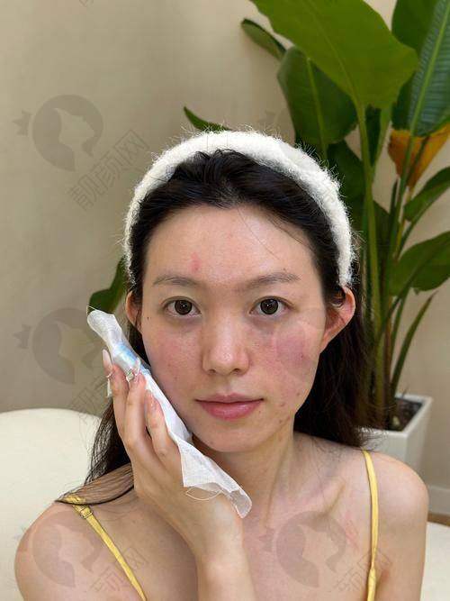 乔雅登美神针的安心保护