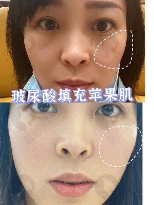 乔雅登美神针的价格与适用范围