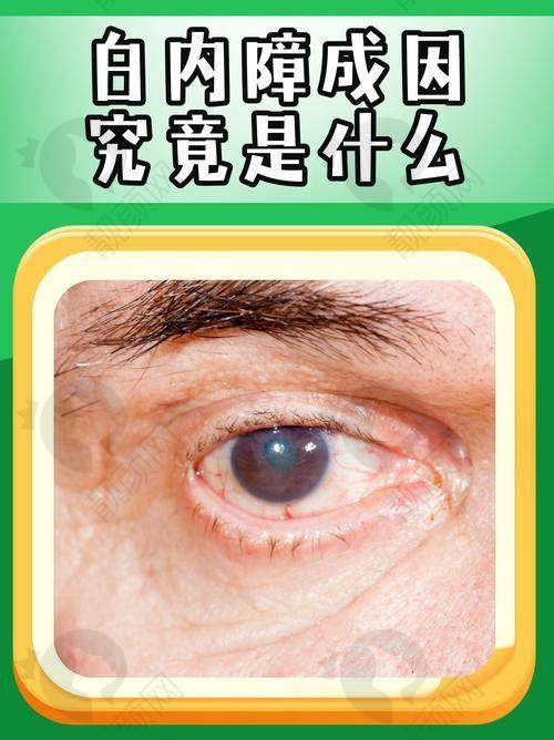 重庆千叶眼科医院：满足多样需求的白内障治疗地