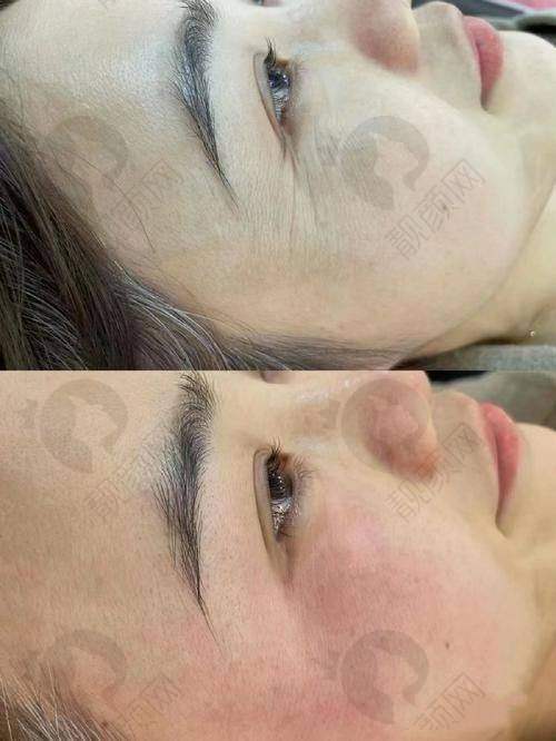 哲晨子玻尿酸的定制化服务