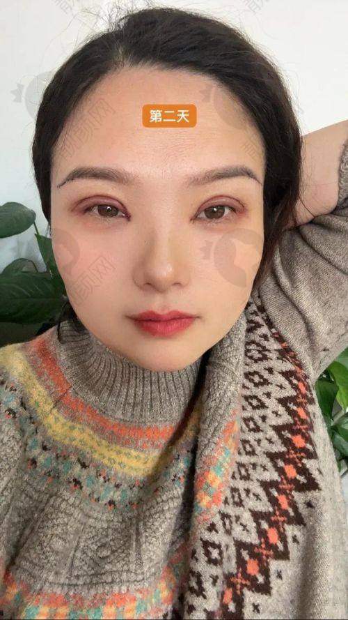 广州华美医院做眼睛好的医生：林晓燕——严谨风格的眼部整形骨干医生
