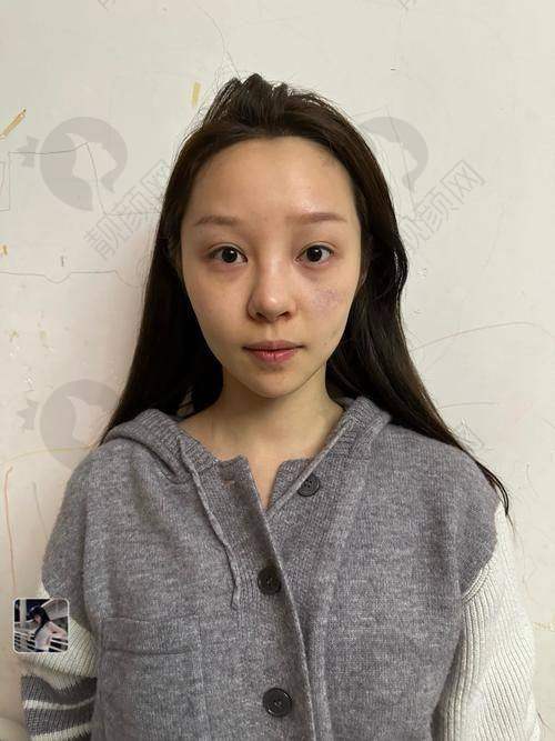 李保锴是哪家医院的医生？——杭州清锴医疗美容门诊部