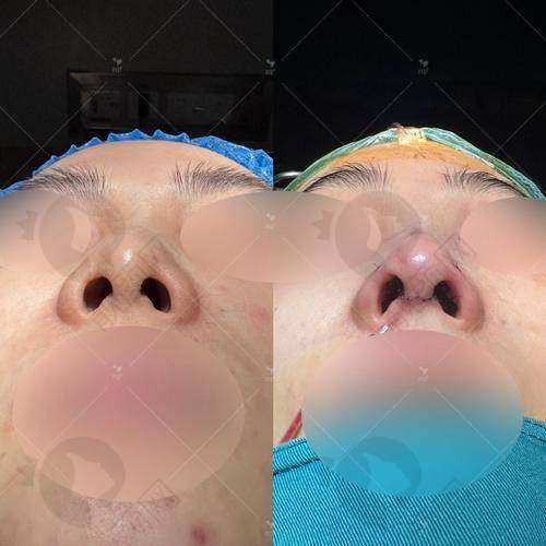 与其他材料对比：优势明显，脱颖而出