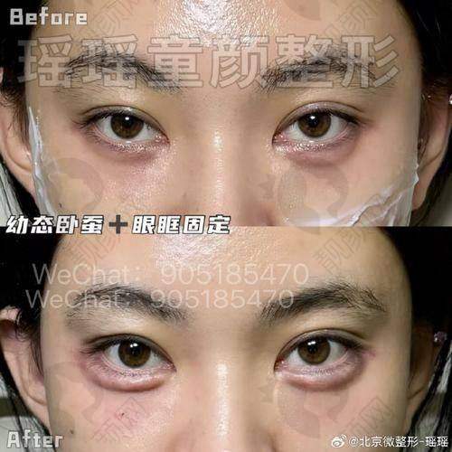 卢元刚医生擅长的眼鼻胸项目