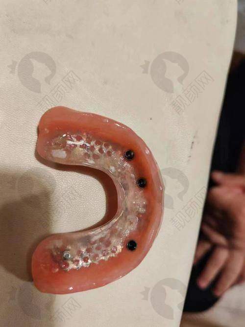 上海维乐口腔：连锁优势明显，材料价格有优势