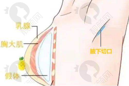 三、广州荔湾区医院整形中 心价格表：（仅供参考）