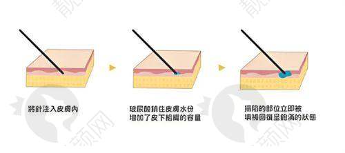 八、广州华美医疗美容医院的口碑评价怎么样