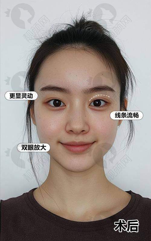 沈阳10大眼部整形医院排名公布！沈阳元辰医疗美容门诊部——本地连锁，特色双眼皮